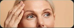 Blefaroplastia